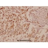 Anti-MMP-16 (T583) Antibody from Bioworld Technology (BS1234) - Antibodies.com