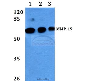 Anti-MMP-19 (G44) Antibody from Bioworld Technology (BS1235) - Antibodies.com