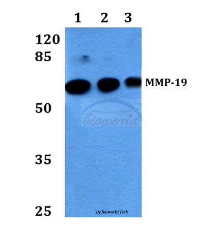 Anti-MMP-19 (G44) Antibody from Bioworld Technology (BS1235) - Antibodies.com