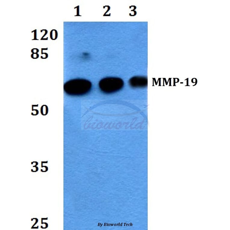 Anti-MMP-19 (G44) Antibody from Bioworld Technology (BS1235) - Antibodies.com