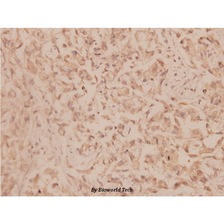 Anti-MMP-19 (G44) Antibody from Bioworld Technology (BS1235) - Antibodies.com