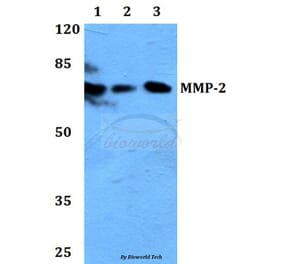 Anti-MMP-2 (L638) Antibody from Bioworld Technology (BS1236) - Antibodies.com