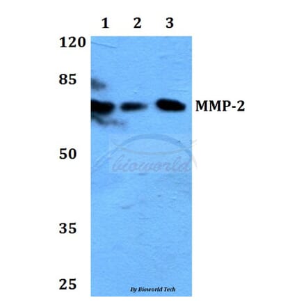 Anti-MMP-2 (L638) Antibody from Bioworld Technology (BS1236) - Antibodies.com