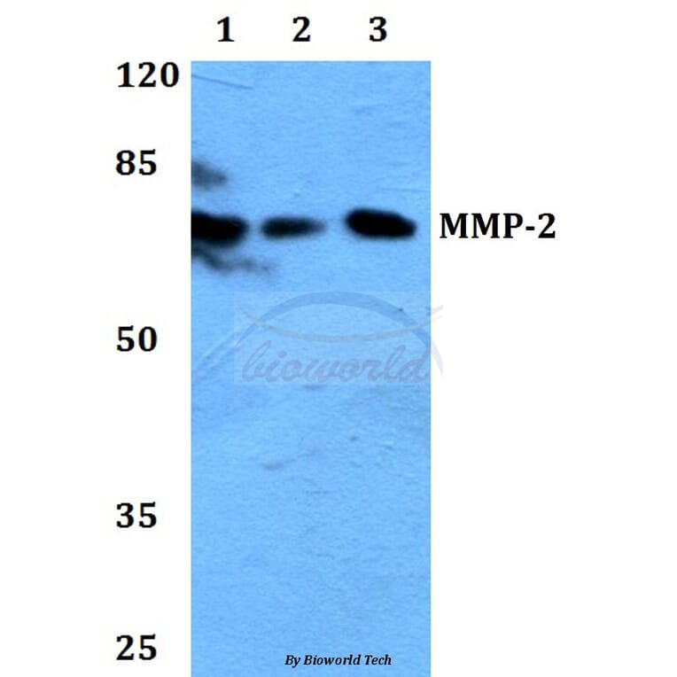 Anti-MMP-2 (L638) Antibody from Bioworld Technology (BS1236) - Antibodies.com