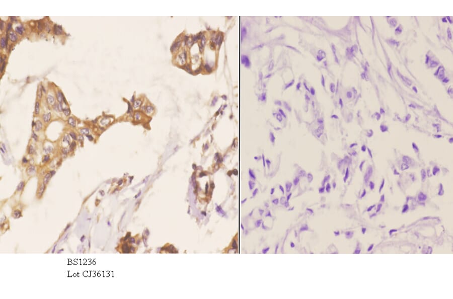 Anti-MMP-2 (L638) Antibody from Bioworld Technology (BS1236) - Antibodies.com
