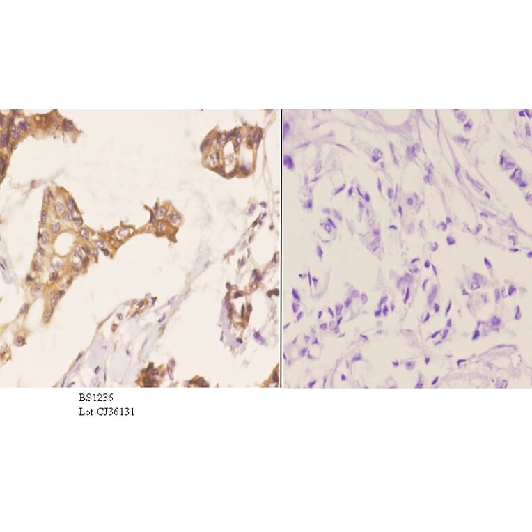 Anti-MMP-2 (L638) Antibody from Bioworld Technology (BS1236) - Antibodies.com