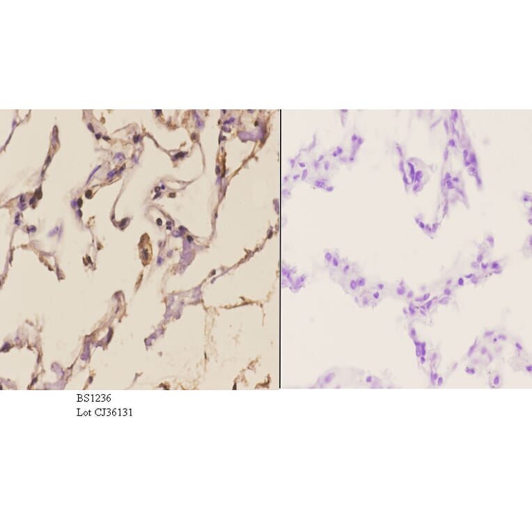 Anti-MMP-2 (L638) Antibody from Bioworld Technology (BS1236) - Antibodies.com