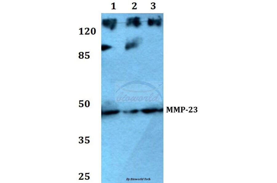 Anti-MMP-23 (V371) Antibody from Bioworld Technology (BS1237) - Antibodies.com