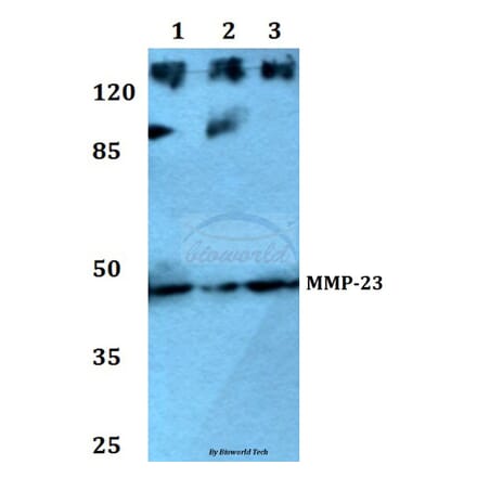 Anti-MMP-23 (V371) Antibody from Bioworld Technology (BS1237) - Antibodies.com