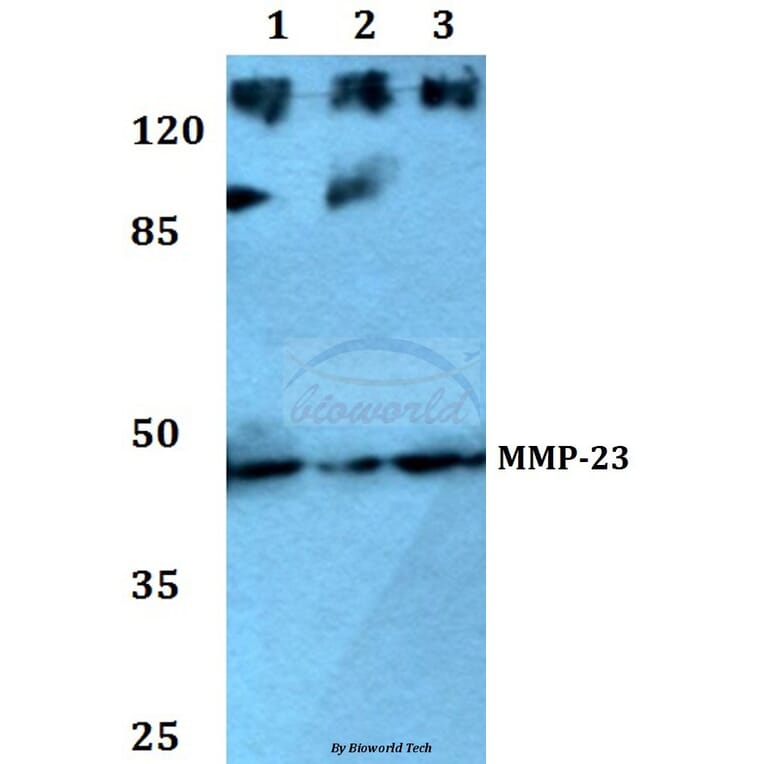 Anti-MMP-23 (V371) Antibody from Bioworld Technology (BS1237) - Antibodies.com