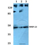 Anti-MMP-23 (V371) Antibody from Bioworld Technology (BS1237) - Antibodies.com