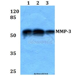 Anti-MMP-3 (S453) Antibody from Bioworld Technology (BS1238) - Antibodies.com