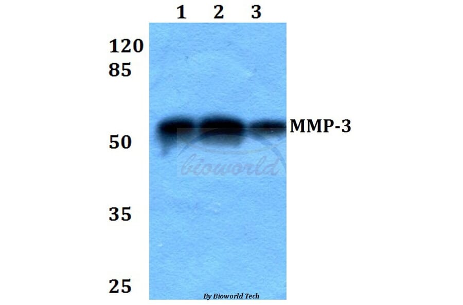 Anti-MMP-3 (S453) Antibody from Bioworld Technology (BS1238) - Antibodies.com