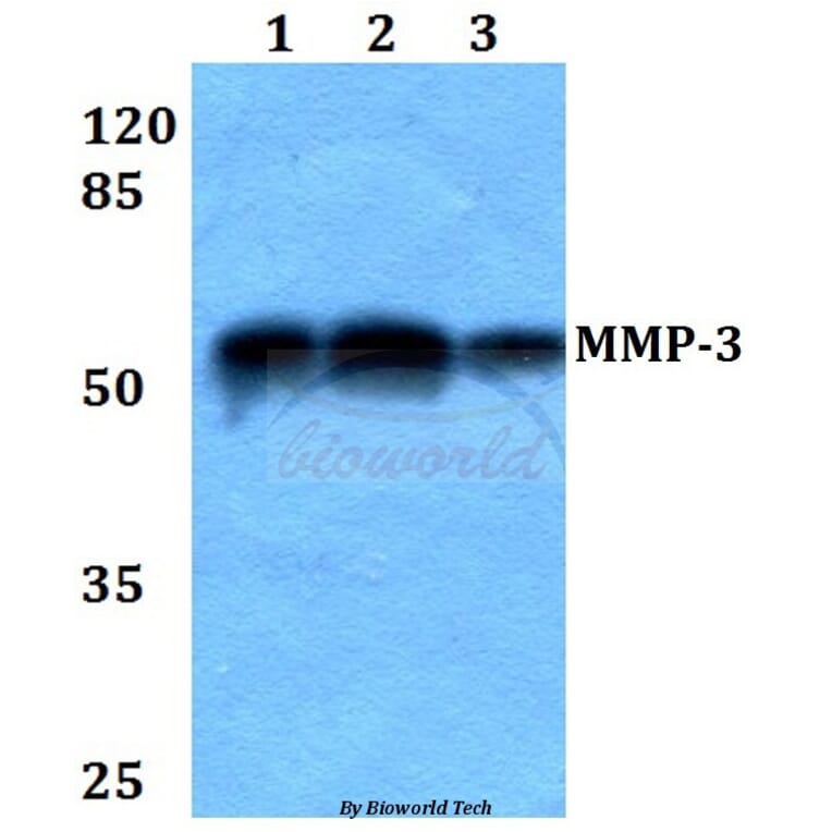 Anti-MMP-3 (S453) Antibody from Bioworld Technology (BS1238) - Antibodies.com