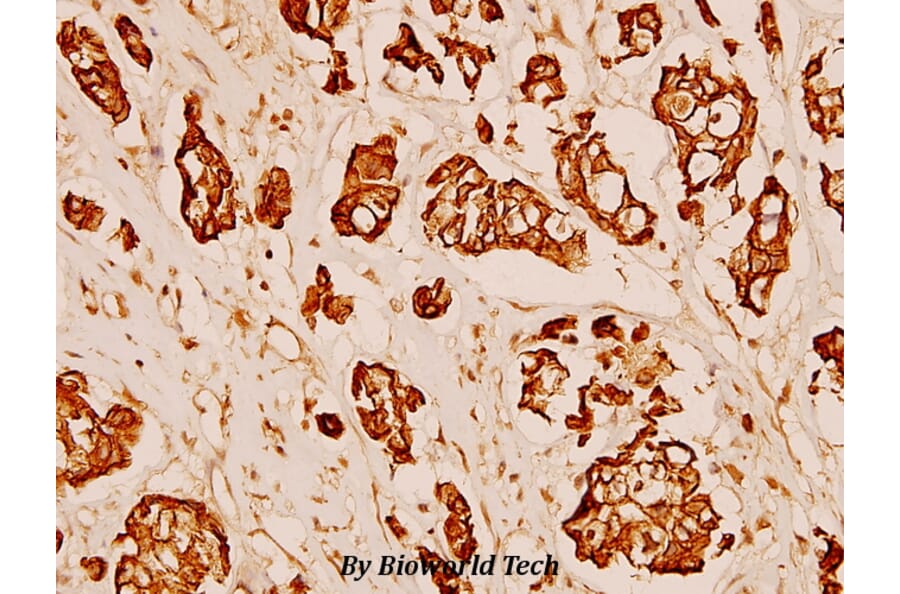 Anti-MMP-3 (S453) Antibody from Bioworld Technology (BS1238) - Antibodies.com