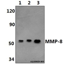 Anti-MMP-8 (F445) Antibody from Bioworld Technology (BS1240) - Antibodies.com
