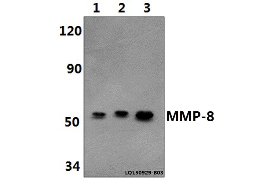 Anti-MMP-8 (F445) Antibody from Bioworld Technology (BS1240) - Antibodies.com