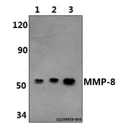 Anti-MMP-8 (F445) Antibody from Bioworld Technology (BS1240) - Antibodies.com