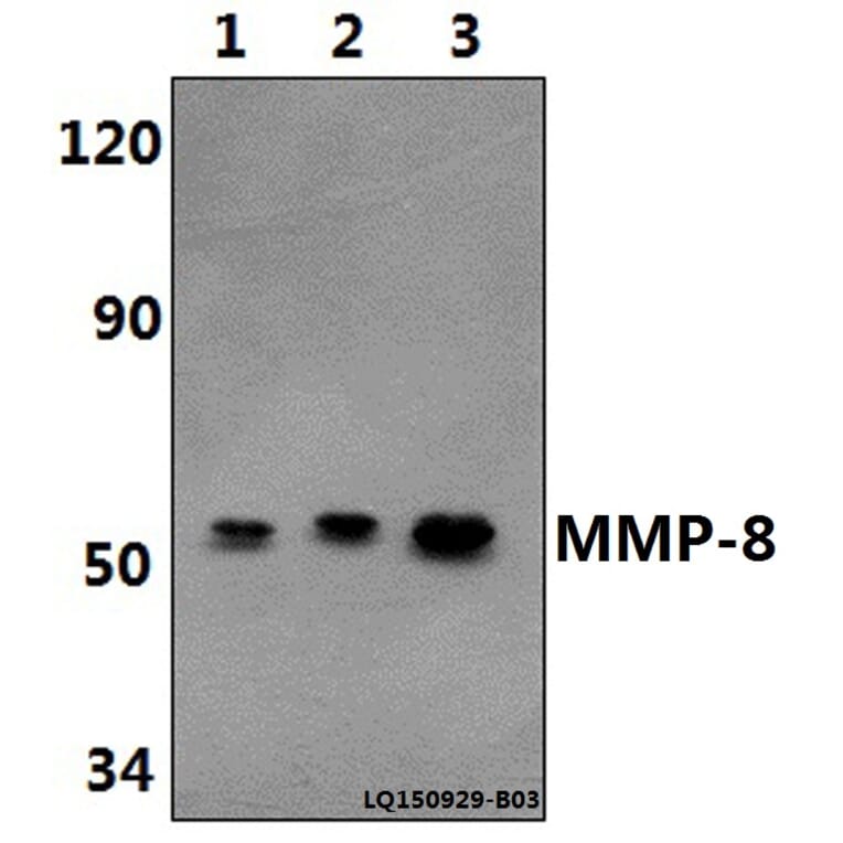 Anti-MMP-8 (F445) Antibody from Bioworld Technology (BS1240) - Antibodies.com