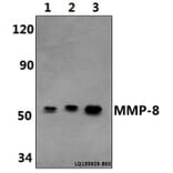 Anti-MMP-8 (F445) Antibody from Bioworld Technology (BS1240) - Antibodies.com