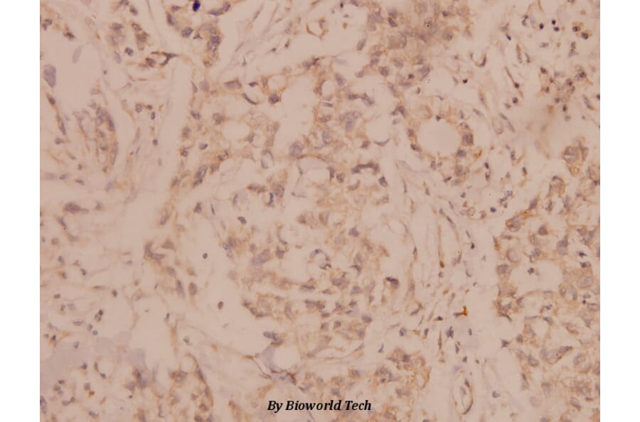 Anti-MMP-8 (F445) Antibody from Bioworld Technology (BS1240) - Antibodies.com