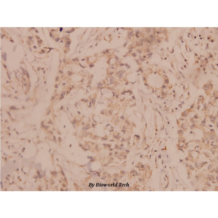 Anti-MMP-8 (F445) Antibody from Bioworld Technology (BS1240) - Antibodies.com
