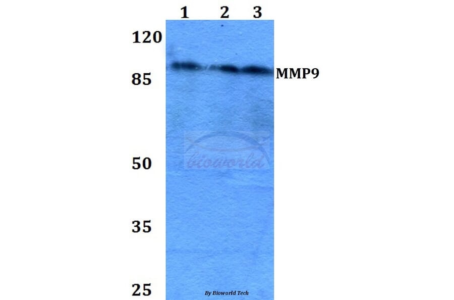 Anti-MMP9 (W680) Antibody from Bioworld Technology (BS1241) - Antibodies.com