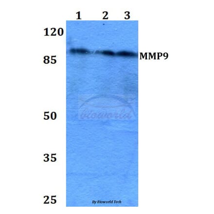 Anti-MMP9 (W680) Antibody from Bioworld Technology (BS1241) - Antibodies.com