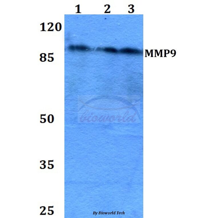 Anti-MMP9 (W680) Antibody from Bioworld Technology (BS1241) - Antibodies.com