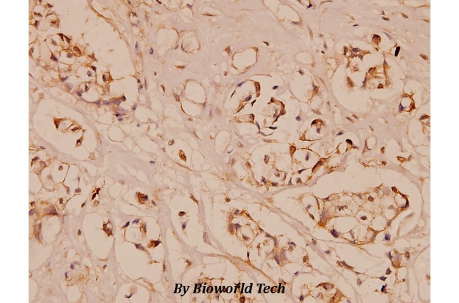 Anti-MMP9 (W680) Antibody from Bioworld Technology (BS1241) - Antibodies.com