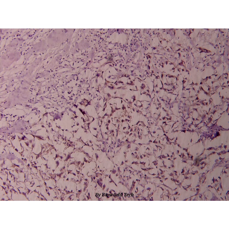 Anti-NFkB-p100 (S865) Antibody from Bioworld Technology (BS1246) - Antibodies.com