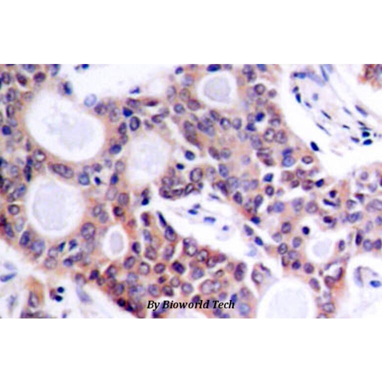 Anti-NFkB-p100 (S869) Antibody from Bioworld Technology (BS1247) - Antibodies.com