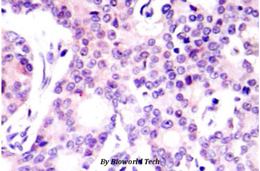 Anti-NFkB-p105 (V887) Antibody from Bioworld Technology (BS1250) - Antibodies.com