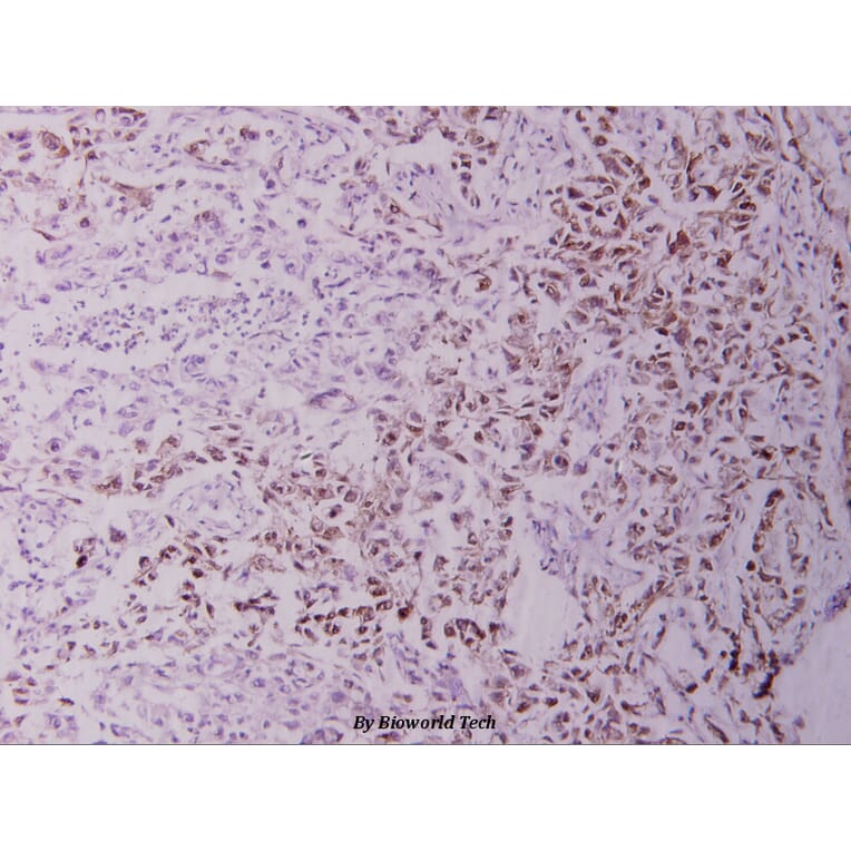 Anti-NFkB-p105 (A901) Antibody from Bioworld Technology (BS1251) - Antibodies.com
