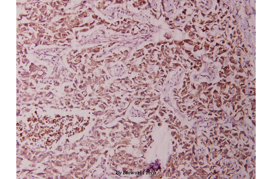 Anti-NFkB-p65 (M270) Antibody from Bioworld Technology (BS1253) - Antibodies.com