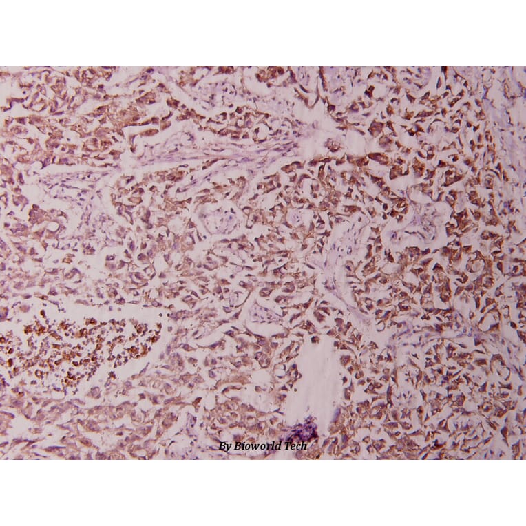 Anti-NFkB-p65 (M270) Antibody from Bioworld Technology (BS1253) - Antibodies.com