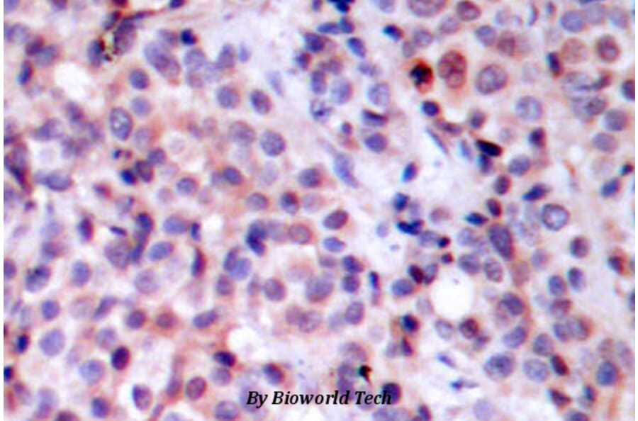 Anti-NFkB-p65 (T429) Antibody from Bioworld Technology (BS1254) - Antibodies.com