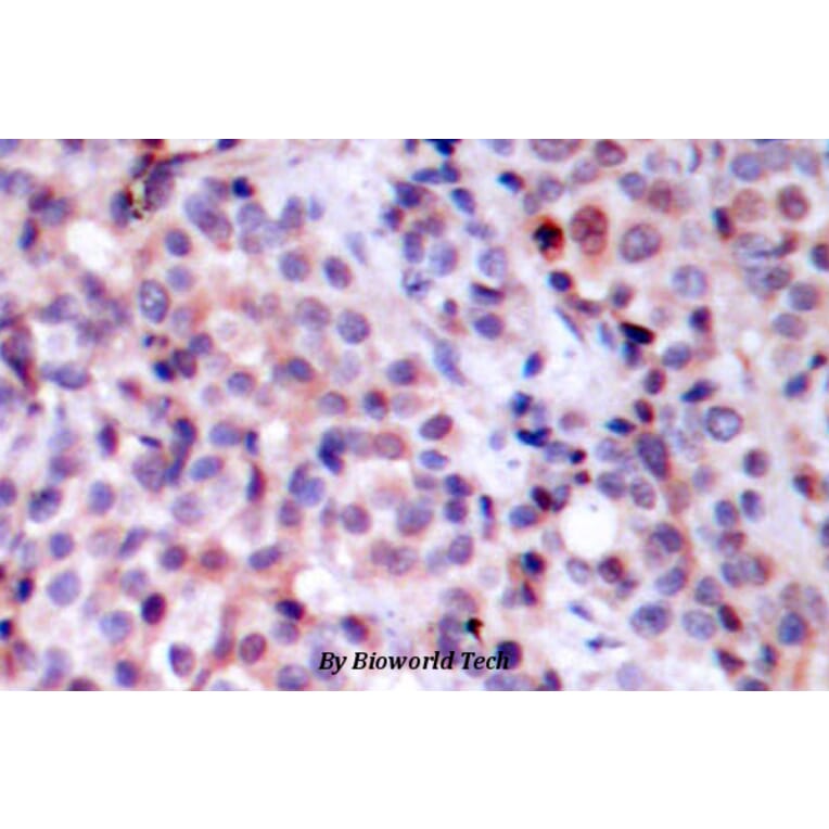 Anti-NFkB-p65 (T429) Antibody from Bioworld Technology (BS1254) - Antibodies.com
