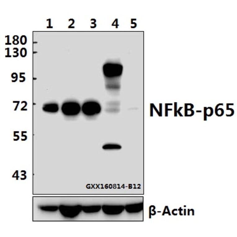 Anti-NFkB-p65 (L523) Antibody from Bioworld Technology (BS1256) - Antibodies.com