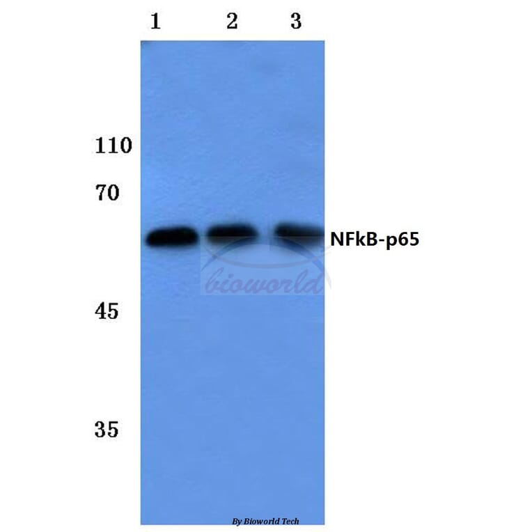 Anti-NFkB-p65 (L523) Antibody from Bioworld Technology (BS1256) - Antibodies.com