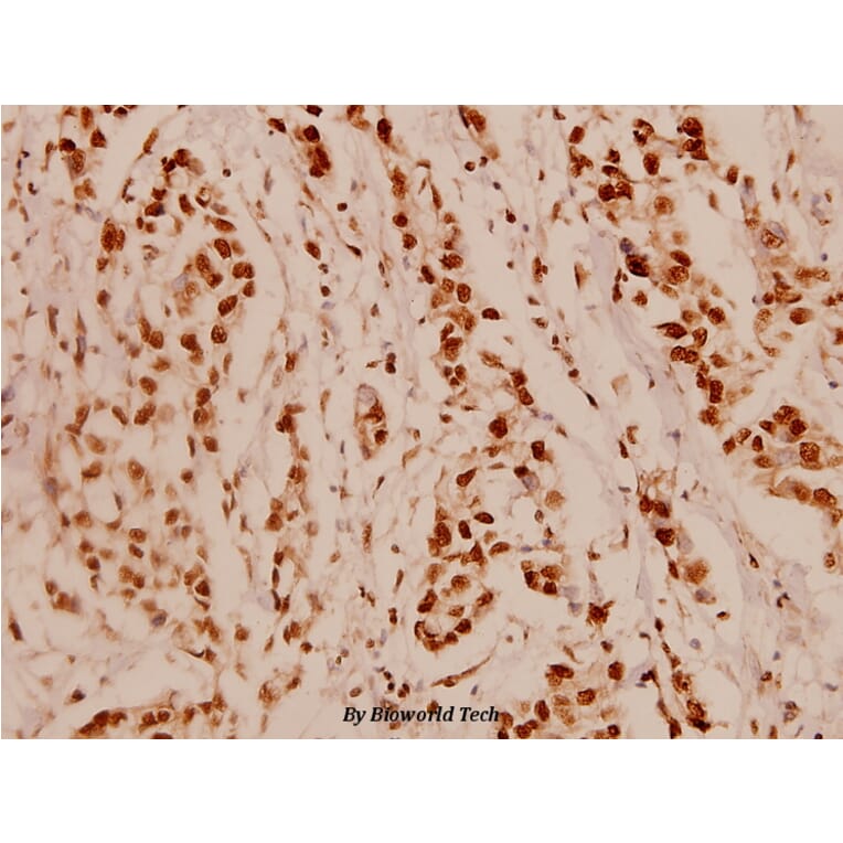 Anti-NFkB-p65 (L523) Antibody from Bioworld Technology (BS1256) - Antibodies.com