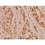 Anti-NFkB-p65 (L523) Antibody from Bioworld Technology (BS1256) - Antibodies.com