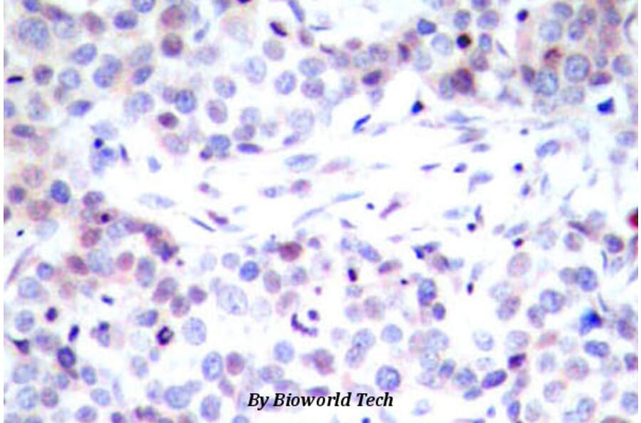 Anti-NFkB-p65 (G530) Antibody from Bioworld Technology (BS1257) - Antibodies.com