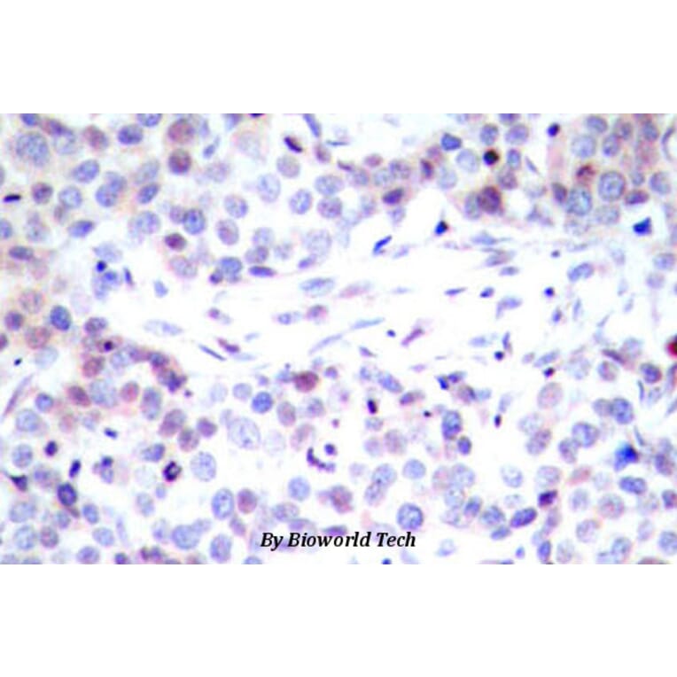 Anti-NFkB-p65 (G530) Antibody from Bioworld Technology (BS1257) - Antibodies.com