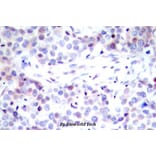 Anti-NFkB-p65 (G530) Antibody from Bioworld Technology (BS1257) - Antibodies.com
