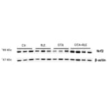 Western Blot - Anti-Nrf2 (L593) Antibody - Antibodies.com
