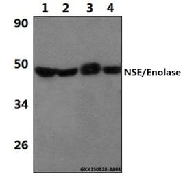 Anti-NSE/Enolase (R400) Antibody from Bioworld Technology (BS1259) - Antibodies.com