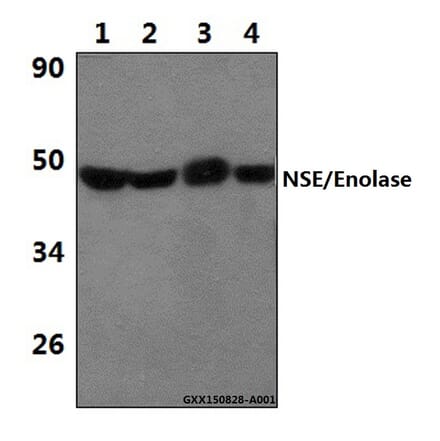Anti-NSE/Enolase (R400) Antibody from Bioworld Technology (BS1259) - Antibodies.com