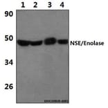 Anti-NSE/Enolase (R400) Antibody from Bioworld Technology (BS1259) - Antibodies.com