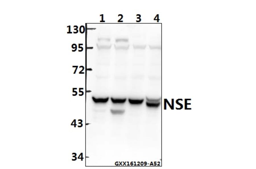 Anti-NSE/Enolase (R400) Antibody from Bioworld Technology (BS1259) - Antibodies.com